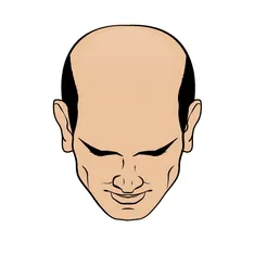 Saç Tipi 5
